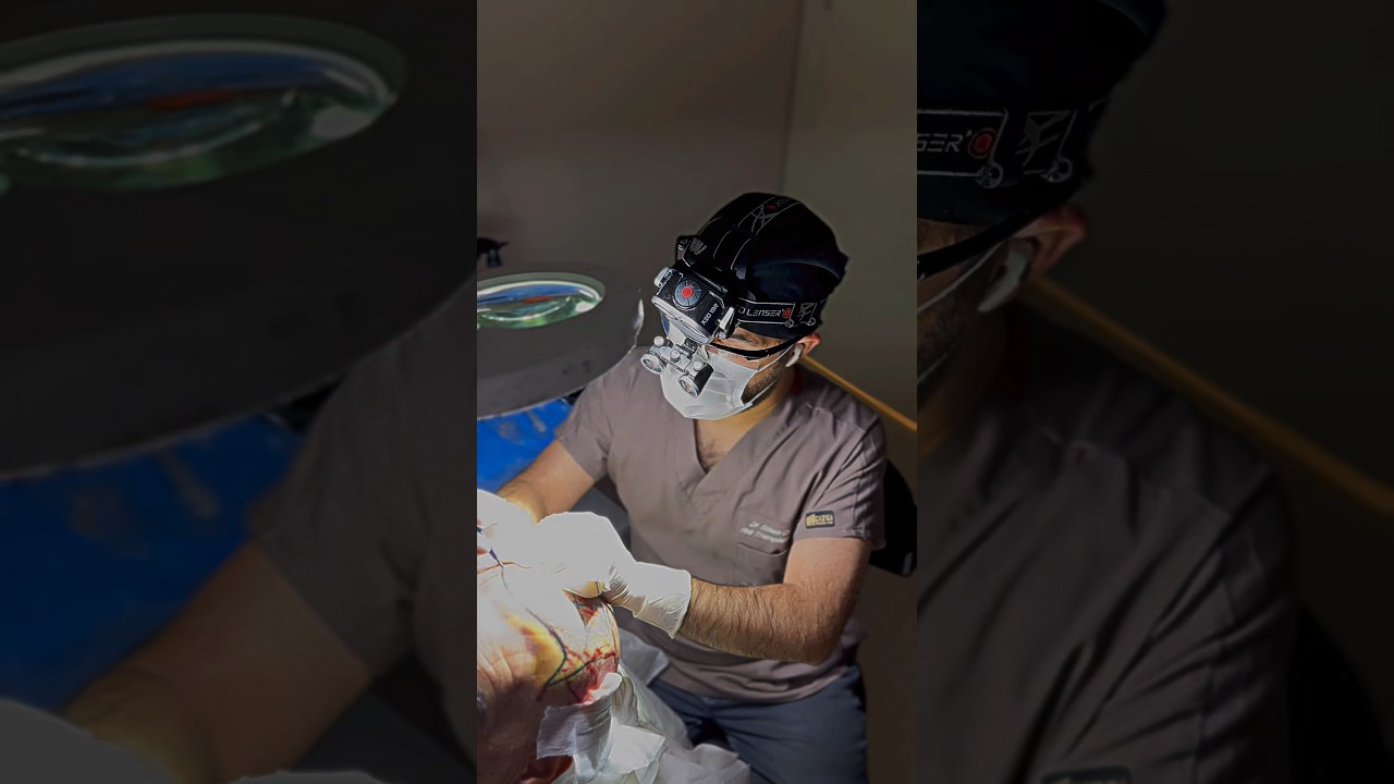 Vip Hair Transplant Operations by Dr Erkam CAYMAZ