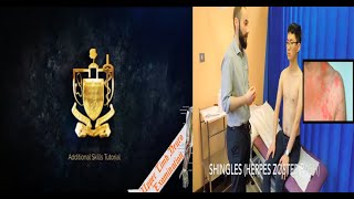 Mayo Medics: Upper Limb Neurological Exam Skills Tutorial