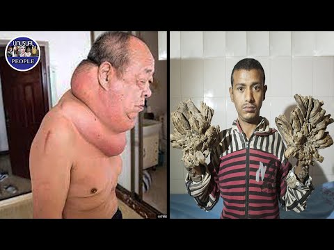 5 UNUSUAL PEOPLE IN THE WORLD PART 34