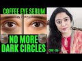 7 DAYS CHALLENGE : DIY COFFEE EYE SERUM To Remove DARK CIRCLES PERMANENTLY in 1 WEEK | Pooja Luthra