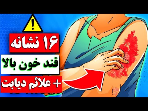 تصویری: نحوه تشخیص نوع انسولین مناسب شما: 11 مرحله