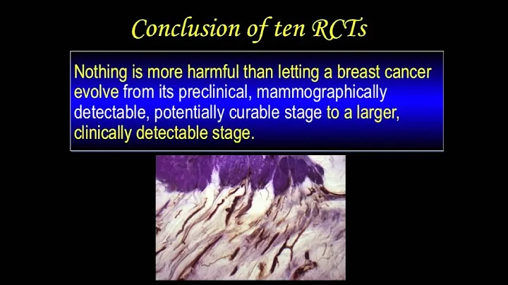 U.S. Preventative Task Force Guidelines: Dr. Tabar Explains Why They're Incorrect
