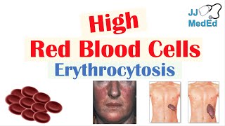 dybtgående tykkelse køretøj High Red Blood Cells (Erythrocytosis) | Causes, Signs and Symptoms, and  Treatment - YouTube