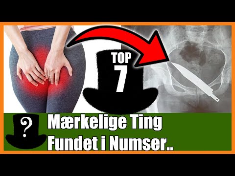 TOP 7 Mærkelige Ting Fundet i Numser..