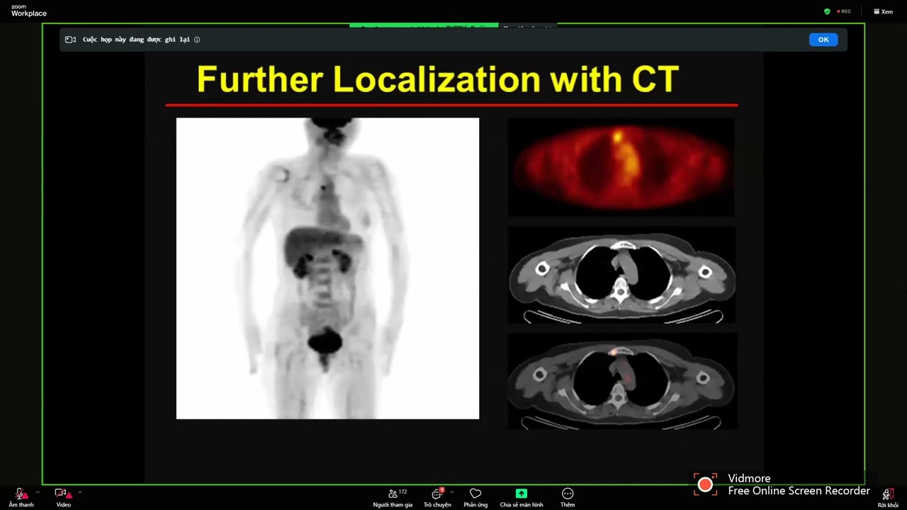 PET/CT TRONG UNG THƯ | PGS. TS. Lê Ngọc Hà