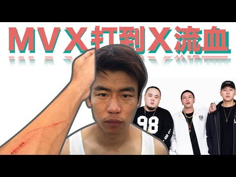 拍頑童的MV被打到留下疤痕？