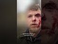 خبرنگار رادیو اروپای آزاد از حمله پهپادی روسیه جان سالم به در برد