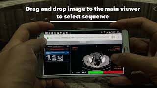 How to use padimedical dicom viewer with android phone screenshot 2