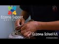 Eczema in the School or Early Learning Environment
