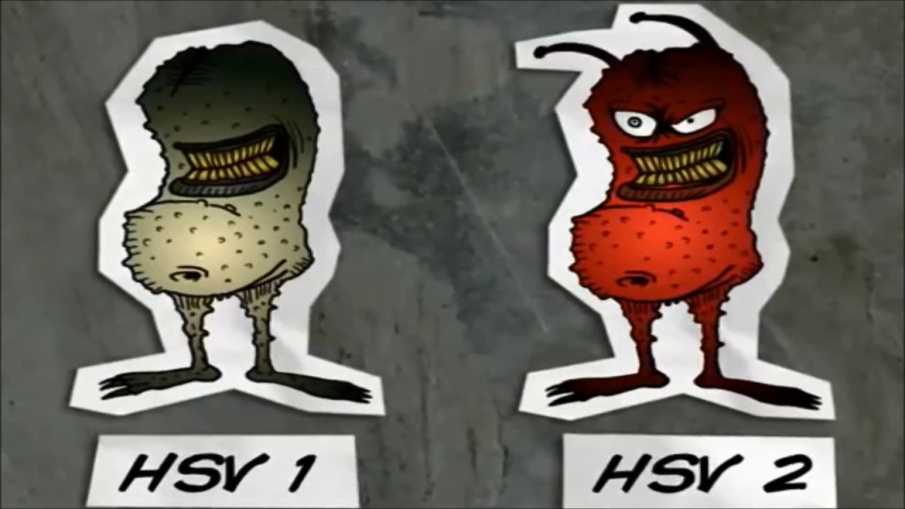 What is Herpes ? How to Treat Herpes ? - YouTube