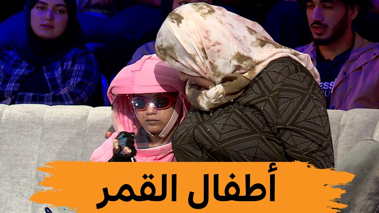 سيدة تحكي معاناة إبنتها المصابة بمرض جفاف الجلد 