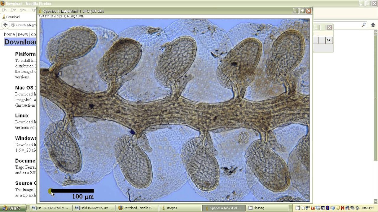 Setting The Scale On Imagej