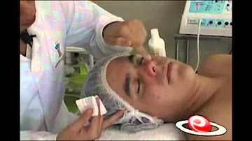 Como ocorre a formação da acne por Propionibacterium acnes?