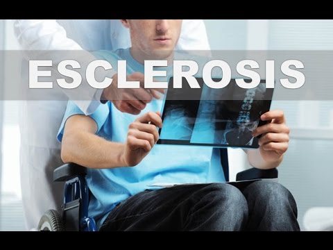 Video: Dioscorea Nipponskaya Es Un Excelente Remedio Para La Esclerosis