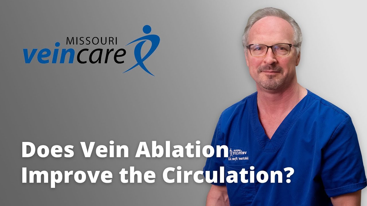 Does Vein Ablation Improve the Circulation?