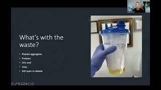 What is EBOO Therapy? | EBOO Specialist Explains