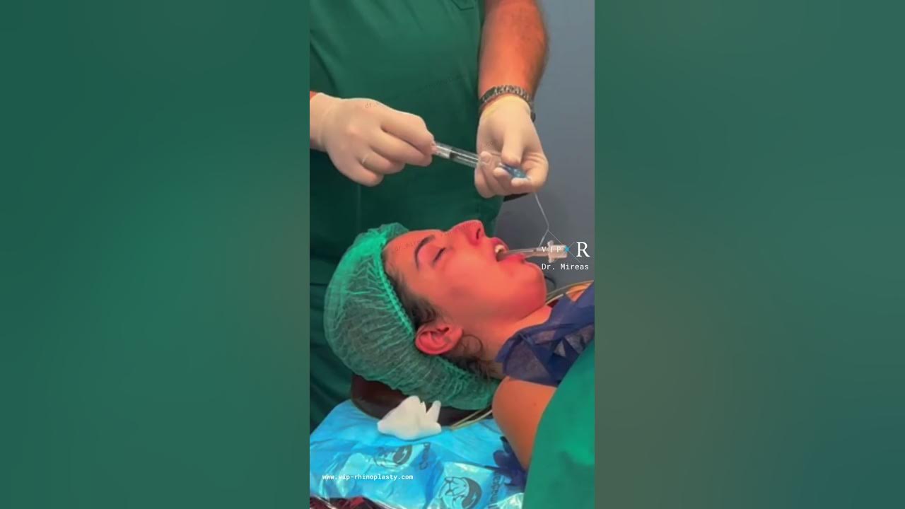 Anesthesia for Rhinoplasty Cosmetic Surgery Intubation General