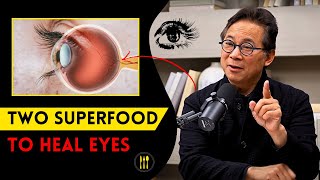 2 SUPERFOOD to HEAL your VISION Loss | Dr. William Li