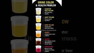 Urine Color = Health Alert 🚨