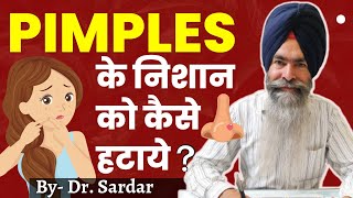 ये गलती मत करना | Pimples/Acne और Pimple Marks का पूरा इलाज | Tips By Dr. Sardar screenshot 5