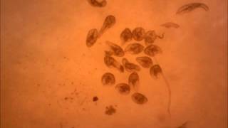 Identification of Chalcones as Fasciola hepatica Cathepsin L Inhibitors Using a Comprehensive