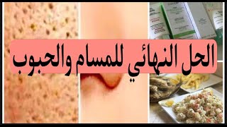 حل سريع للمسام الواسعة وحبوب / غداء صيفي وصحي حافظي على جسمك