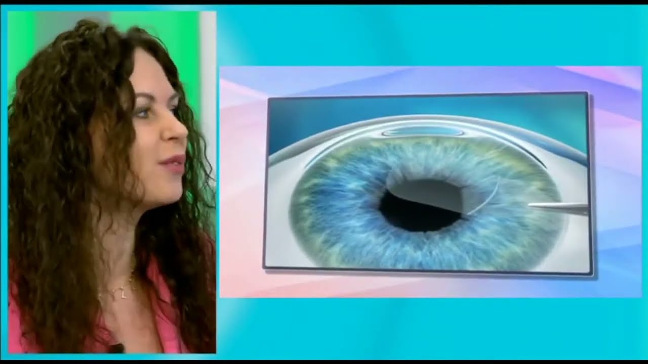 Коррекция зрения: что такое лентикула, и каким пациентам она показана?