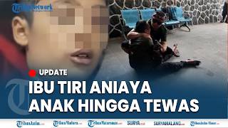 🔴 BOCAH TEWAS PENUH LUKA BAKAR DI SUKABUMI, Diduga Dianiaya Ibu Tiri Hingga Luka-luka