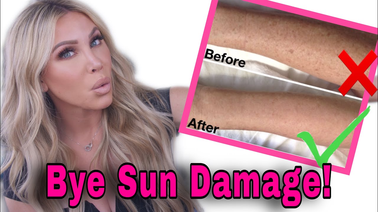 2 Steps to ERASE SUN DAMAGE, HYPERPIGMENTATION on Your Body AT-HOME