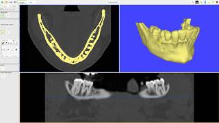 How to import DICOM in AxisGuide Pro software!