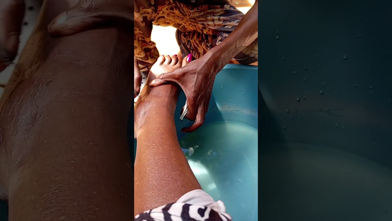 Traditional Healing Method For Swollen Feet. 