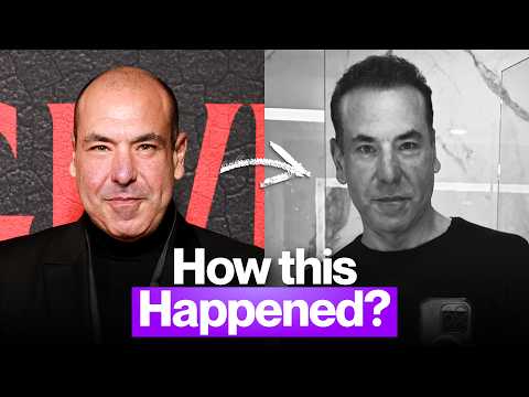 Rick Hoffman's Hair Transformation: How Did a Norwood 5+ Get This Result? thumbnail