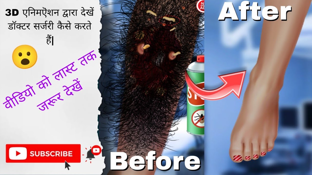 3D animation dwara doctor Ilaaj kaise karte hain Chaliye dekhte hain