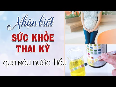 Màu nước tiểu