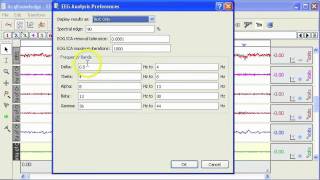 EEG - Automated Filtering