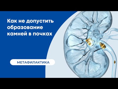 Как не допустить образование камней в почках
