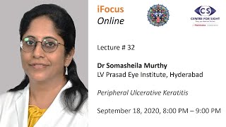 iFocus Online, Session 32