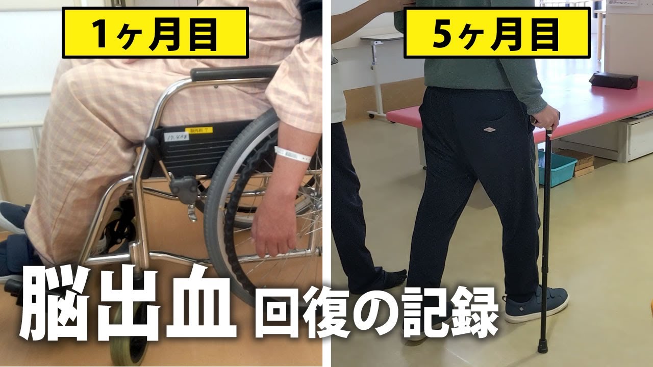 車椅子から杖歩行まで 脳出血発症後半年間の片麻痺リハビリ記録 Record of hemiplegic rehabilitation