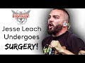 Jesse Leach Undergoes SURGERY! | Killswitch Engage Vocalist