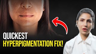 Get Clear Skin In Just 4 Weeks Best Treatment For Hyperpigmentation