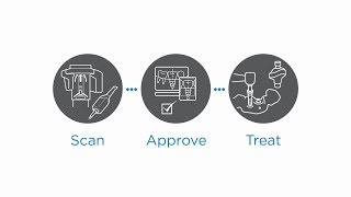 Azento digital implant workflow animation