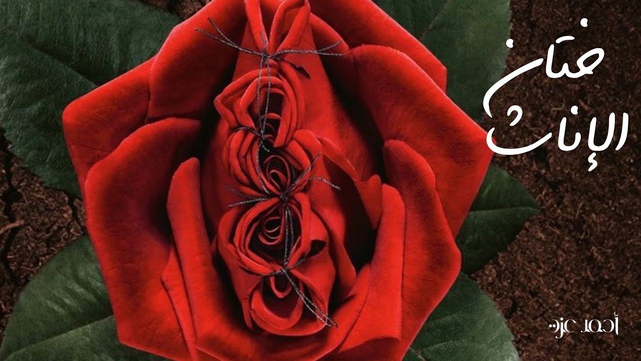 ختان الإناث