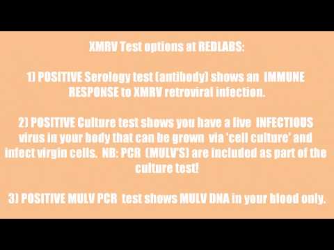 XMRV blood tests available to UK & Europe - FACEBOOK THIS!!!