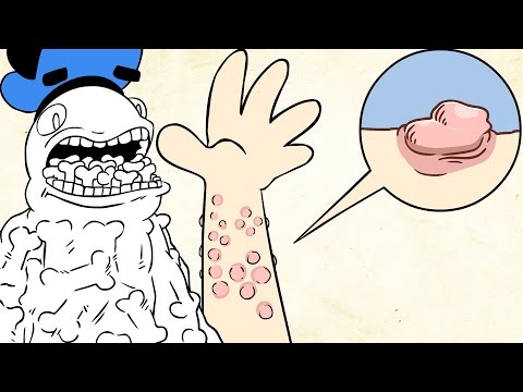 what-happens-if-you're-allergic-to-water?-|-dolan-life-mysteries