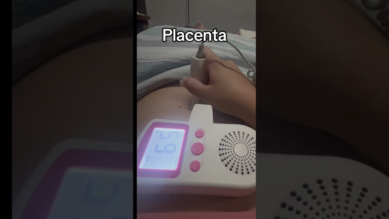 DIFERENÇA ENTRE O SOM DOS BATIMENTOS CARDÍACOS E A PLACENTA 