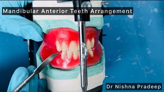 Mandibular anterior teeth arrangement 👍 Stepwise  demo of the guidelines