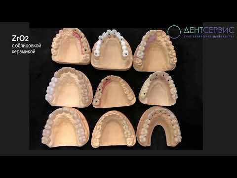 Обзор популярных ортопедических конструкций-