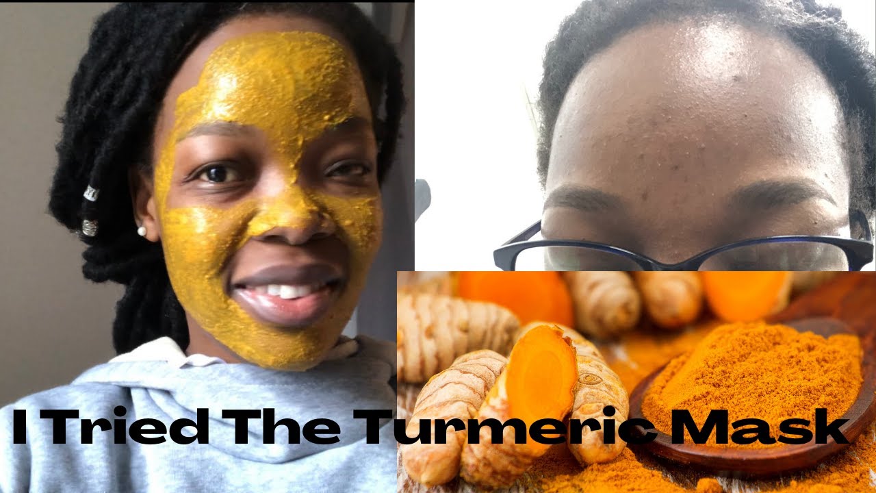 Turmeric MASK for HYPERPIGMENTATION before AND after (6 DAY TRIAL