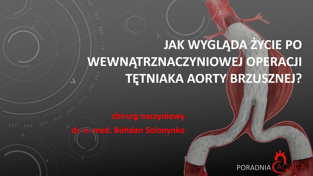 Ile Się żyje Po Operacji Tętniaka Aorty Brzusznej - JAK WYGLĄDA ŻYCIE PO WĘWNĄTRZNACZYNIOWEJ OPERACJI TĘTNIAKA AORTY