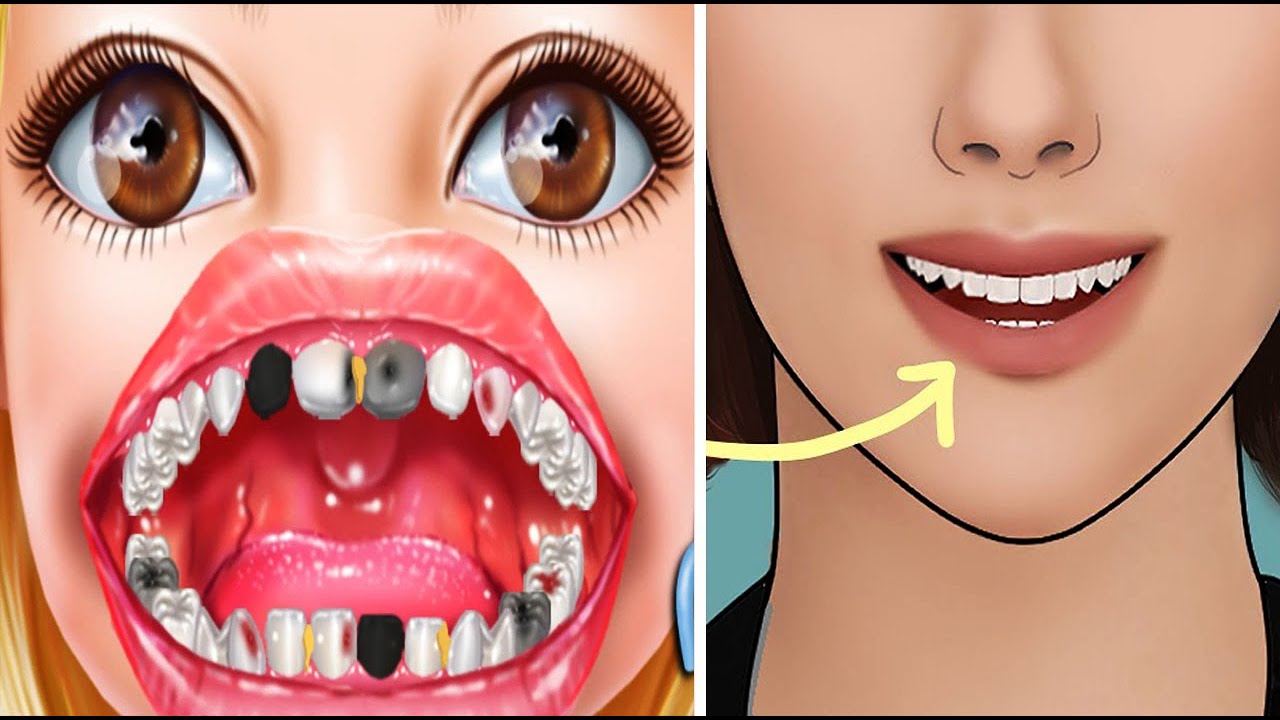 [ASMR] Tartar removal animation / Dental Scaling / Satisfying YouTube